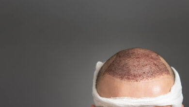 أفضل ثلاث مراكز زراعة شعر في الإمارات