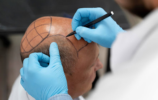 مركز اليت هير